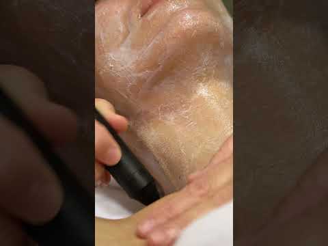 Indiba Facial 50’.